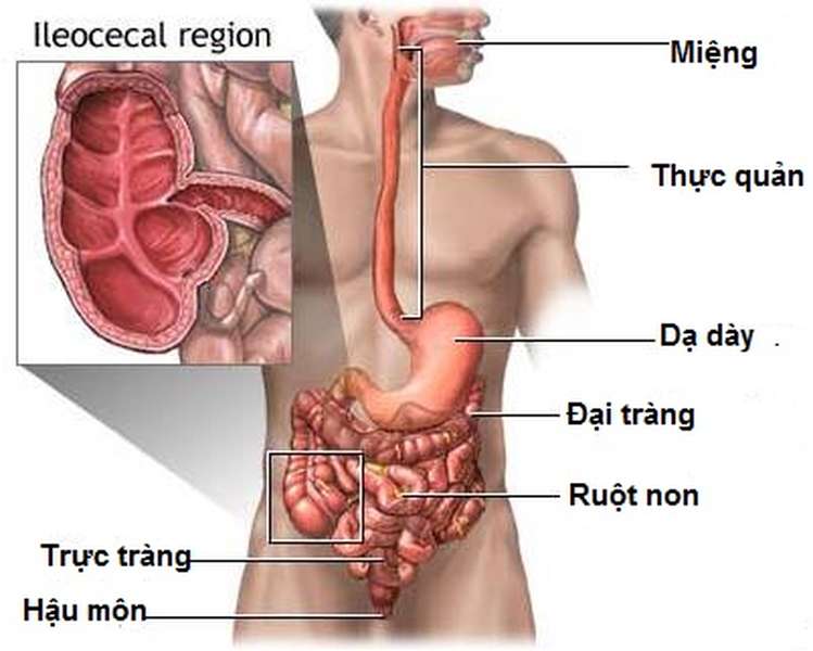 Crohn - Hình ảnh minh họa